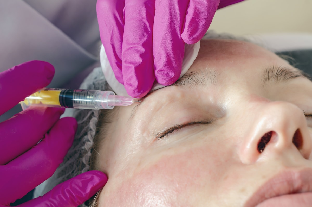 Microneedling Básico